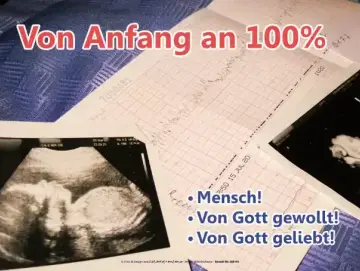 Poster A2: Sonografieausdrucke von ungeborenem Kind